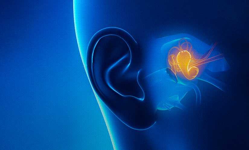 Perda auditiva neurossensorial